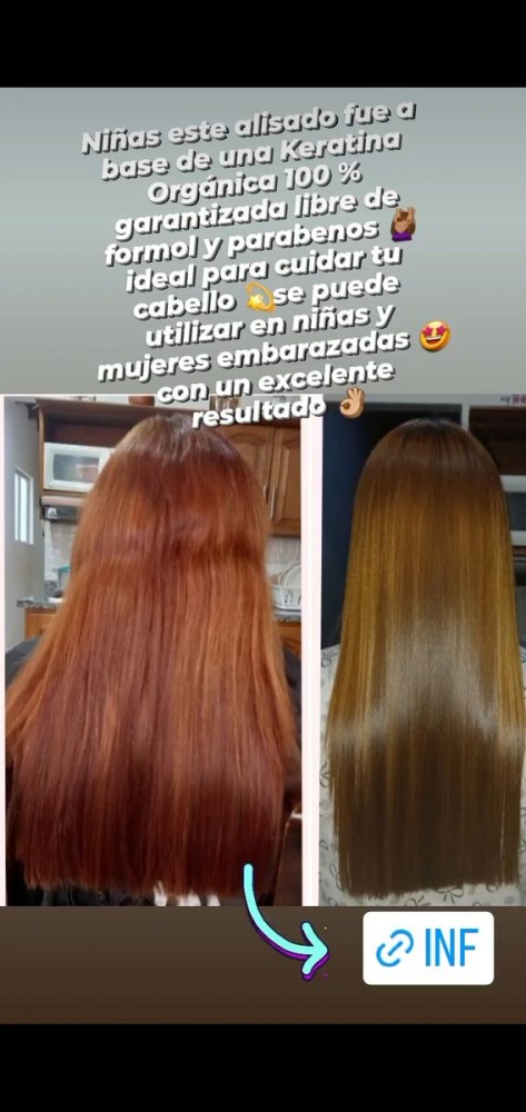 Imagen #1 de Anónimo