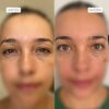 Complejo-Antiedad-Contorno-de-ojos-Aruná